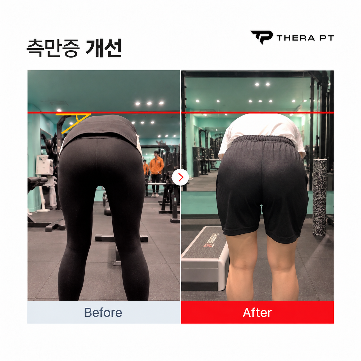테라PT 수업 비포애프터 기록 6