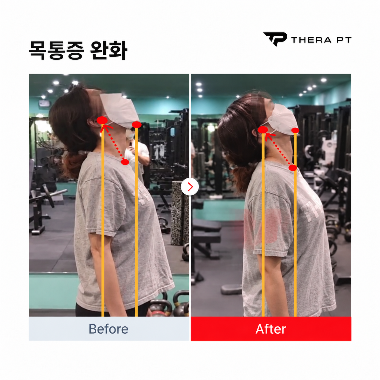 테라PT 수업 비포애프터 기록 3
